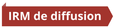 irm-diffusion